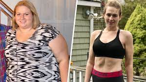 pcos caused her obesity how she then
