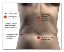 what is the gallbladder what causes