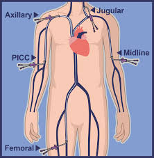 picc services vascular wellness