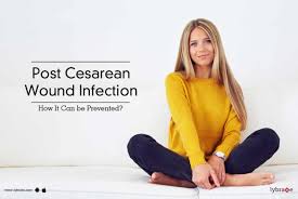 post cesarean wound infection how it