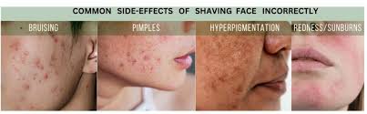 causes of hyperpigmentation after