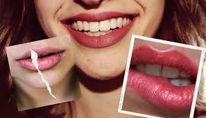 how to beat dry lips this winter the