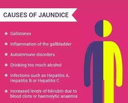 What Should Be The Diet For Jaudice Patients Quora