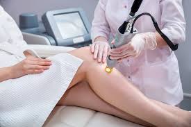 is laser hair removal painful how to
