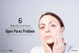 6 natural remes to cure open pores