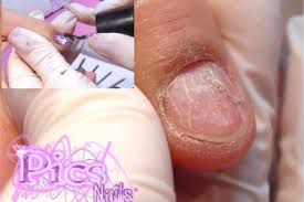 can i do nails extension if i have a