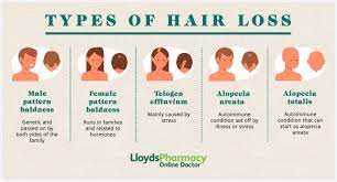 10 causes of hair loss lloydspharmacy