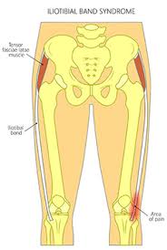 Human anatomy diagrams show internal organs, cells, systems, conditions, symptoms and sickness information and/or tips for healthy. Hip Injury Pain Southlake Hip Conditions Southlake