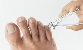 toenail shape and ingrown nails