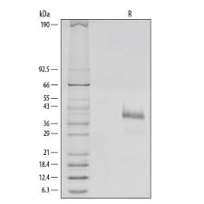 Recombinant Human R Spondin 1 Protein