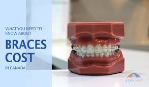 Braces with dental insurance cost. Braces Cost In Canada And Orthodontic Insurance Explained