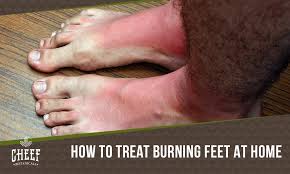 home remes for burning feet 12 easy