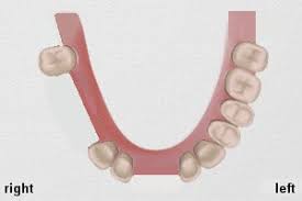dental bridge from theory to practice