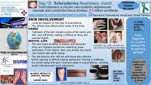 day 18 scleroderma awareness month