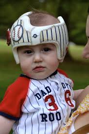 Pin By Leigh Gibson On Cranial Bands Helmets Baby Helmet