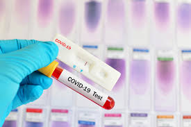 Where can i get tested? Covid 19 Tests Keralty