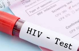HIV prevalence: Nigeria moving towards epidemic control – National  Coordinator - Vanguard News
