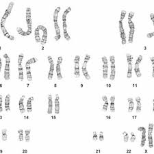 Harvesting cells (usually from a foetus or white blood cells of adults). Karyotype Showing Trisomy 13 Indicated By The Extra Copy Of Chromosome 13 Download Scientific Diagram