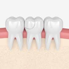 chipped tooth causes and treatment