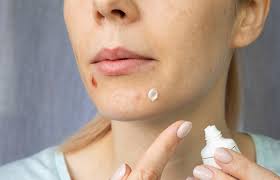 how to get rid of scabs on face