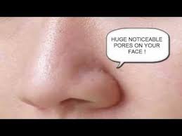 The best way to handle enlarge skin pores would be. How To Get Rid Of Big Pores On Nose Big Pores On Nose Youtube