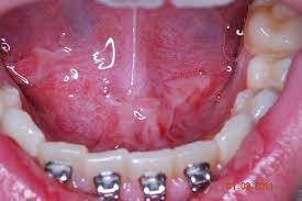 com may 2016 uw of dentistry