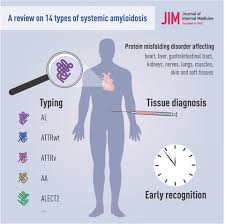 systemic amyloidosis from a aa to t