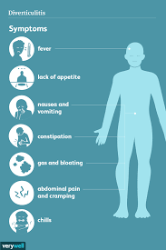 symptoms of diverticulitis