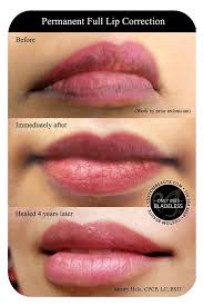 permanent lips in amherst buffalo and