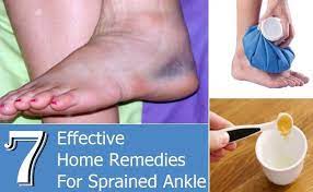7 effective home remes for sprained