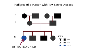 Pedigree Of A Person With The Tay Sachs Disease By Kaly I On