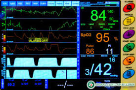 Image result for Anesthetic monitor picture with EKG shown