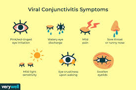viral conjunctivitis treatment