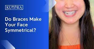 do braces make your face symmetrical