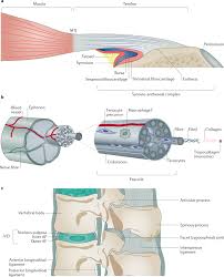 Tendonitis is the swelling of a tendon, which is a thick cord attaching a muscle to a bone. Tendon And Ligament Mechanical Loading In The Pathogenesis Of Inflammatory Arthritis Nature Reviews Rheumatology
