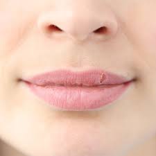 lip blush gone wrong risks side effects
