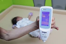New Painless Jaundice Test For Newborns At Polyclinics