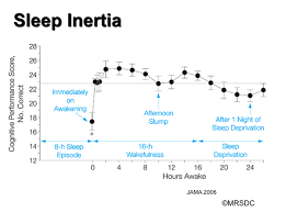 You feel drowsy and groggy. How Naps Affect Your Brain And Why You Should Have One Every Day