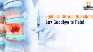 epidural steroid injections say
