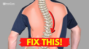 how to relieve your scoliosis back pain