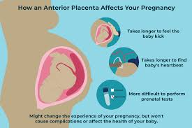 anterior placenta how it affects