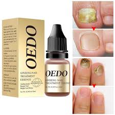 yellowing nail thickening concave inner