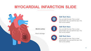.myocardial infarction mortality 1.0 introduction in the uk, about 838,000 men and 394,000 women have had a myocardial infarction (mi) at some point in their lives, (nice clinical guideline 48, 2007). Myocardial Infarction Powerpoint Diagram Slidemodel