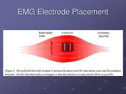 Ppt Electromyography Emg Instrumentation Powerpoint