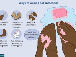 mon fungal and bacterial infections