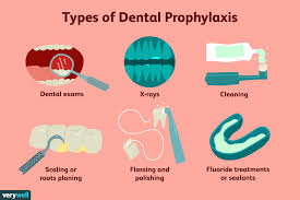dental prophylaxis what s involved