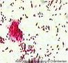 Image result for mycobacterium phlei schizophrenia