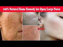 large pores get smooth fairer skin