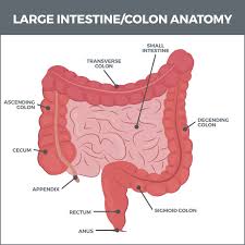 intestinal perforation