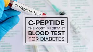 The C Peptide Test The Most Important Blood Test For Diabetes